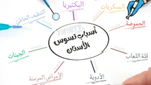 اسباب تسوس الاسنان