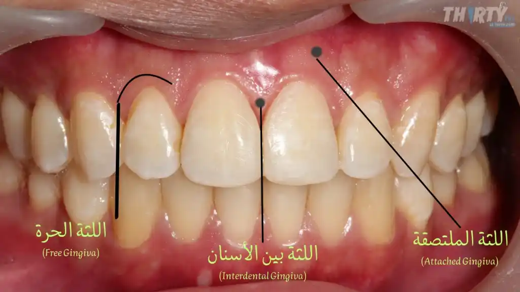 اجزاء اللثة