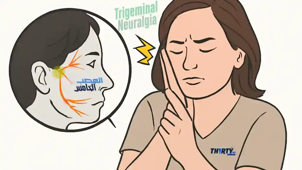 ألم العصب الخامس (Trigeminal Neuralgia)