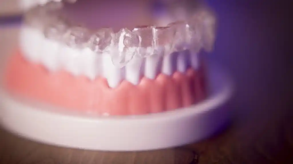 تقويم الأسنان الشفاف